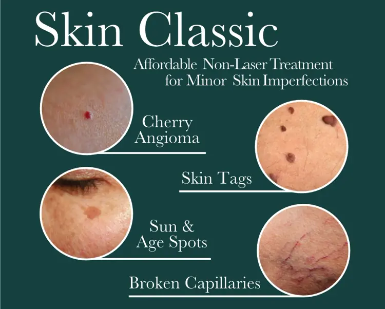 Skin Classic